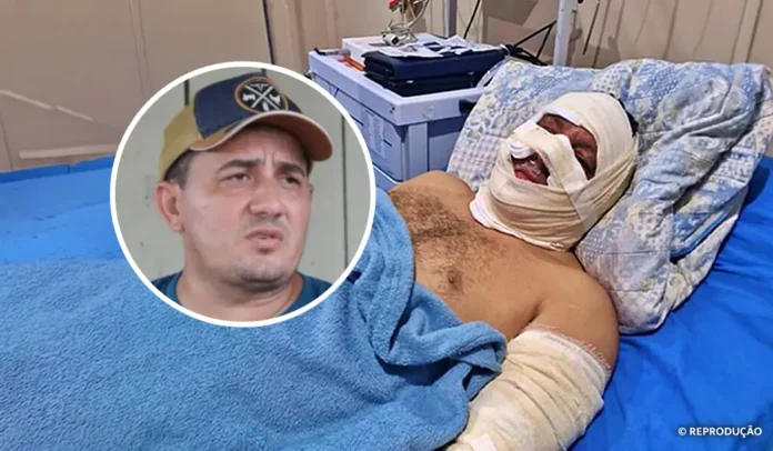 Simao-Peixoto-Acidente-Lancha