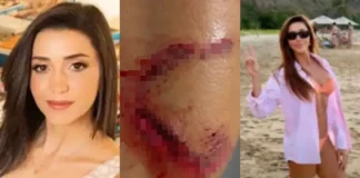 Turista é atacada por tubarão em Fernando de Noronha