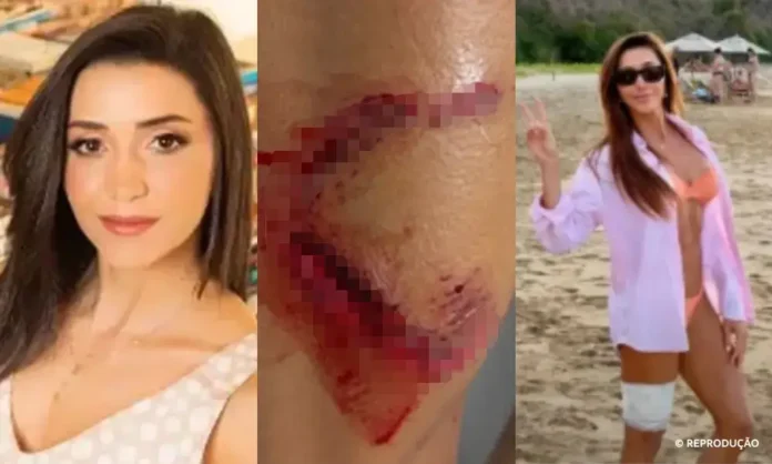 turista-mordida-por-tubarao-em-fernando-de-noronha_reproducao